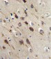 BDNF Antibody (C-term)